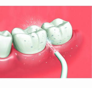 idropulsore migliore